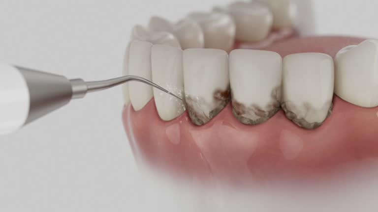 Trusted Root Canal Treatment service in Buchanan, VA - Dentist Open Now